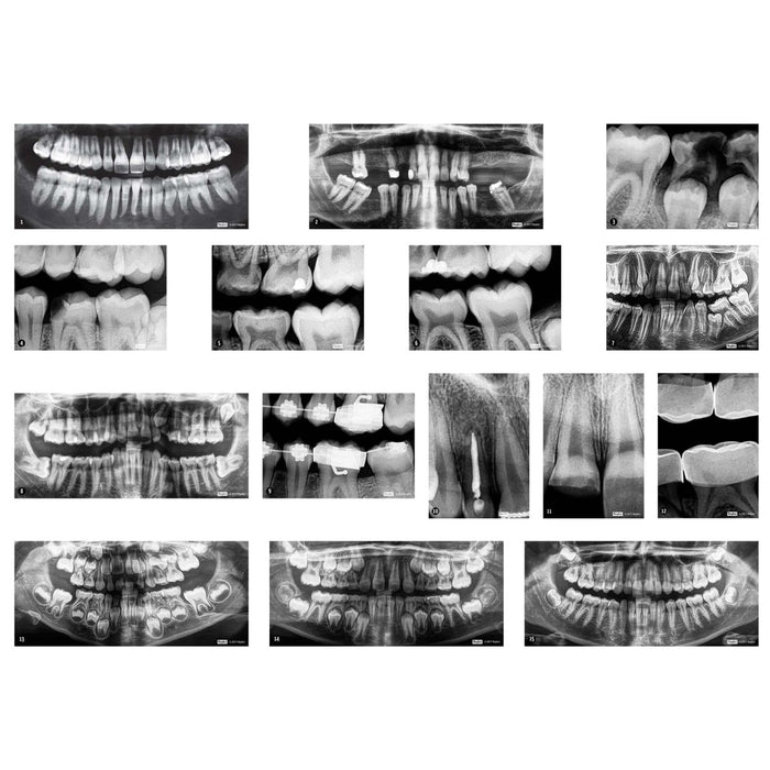 Dental X-Rays - Kidsplace.store